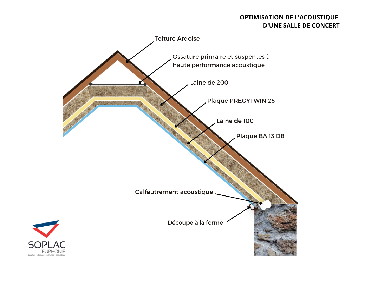 Soplac Euphonie Plaquiste Lorient Optimisation Acoustique